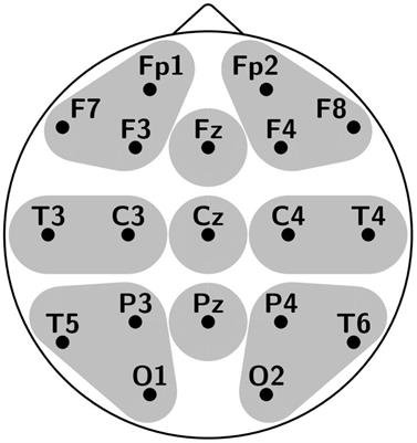 Frequency Effects on Spelling Error Recognition: An ERP Study